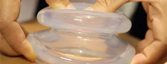 Cupping Therapy in Seattle, WA Cupping Therapy in Seattle, WA