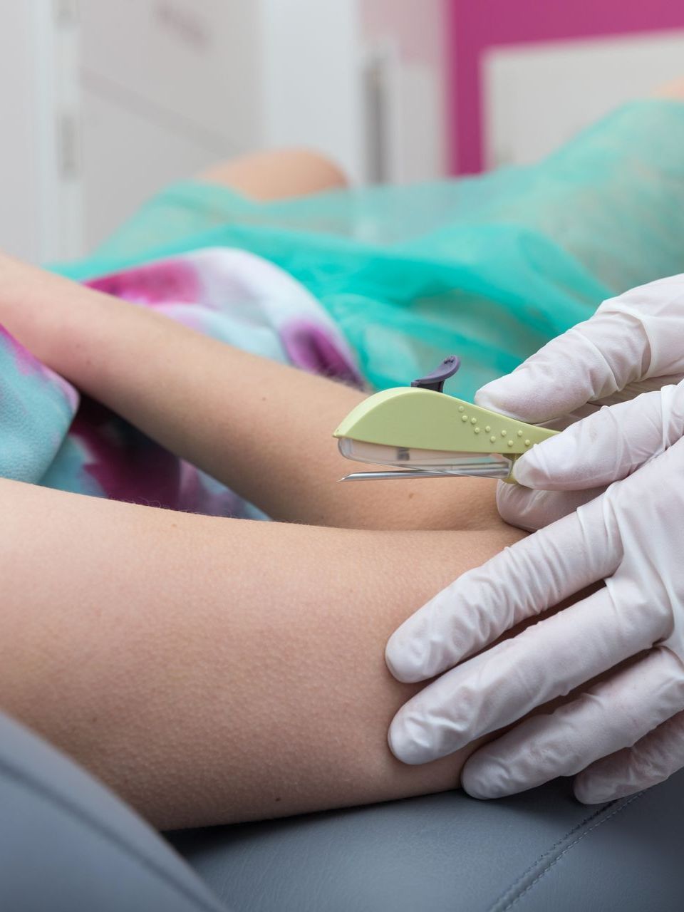A gloved hand holds a skin stapler over a patient’s arm in a clinical setting.
