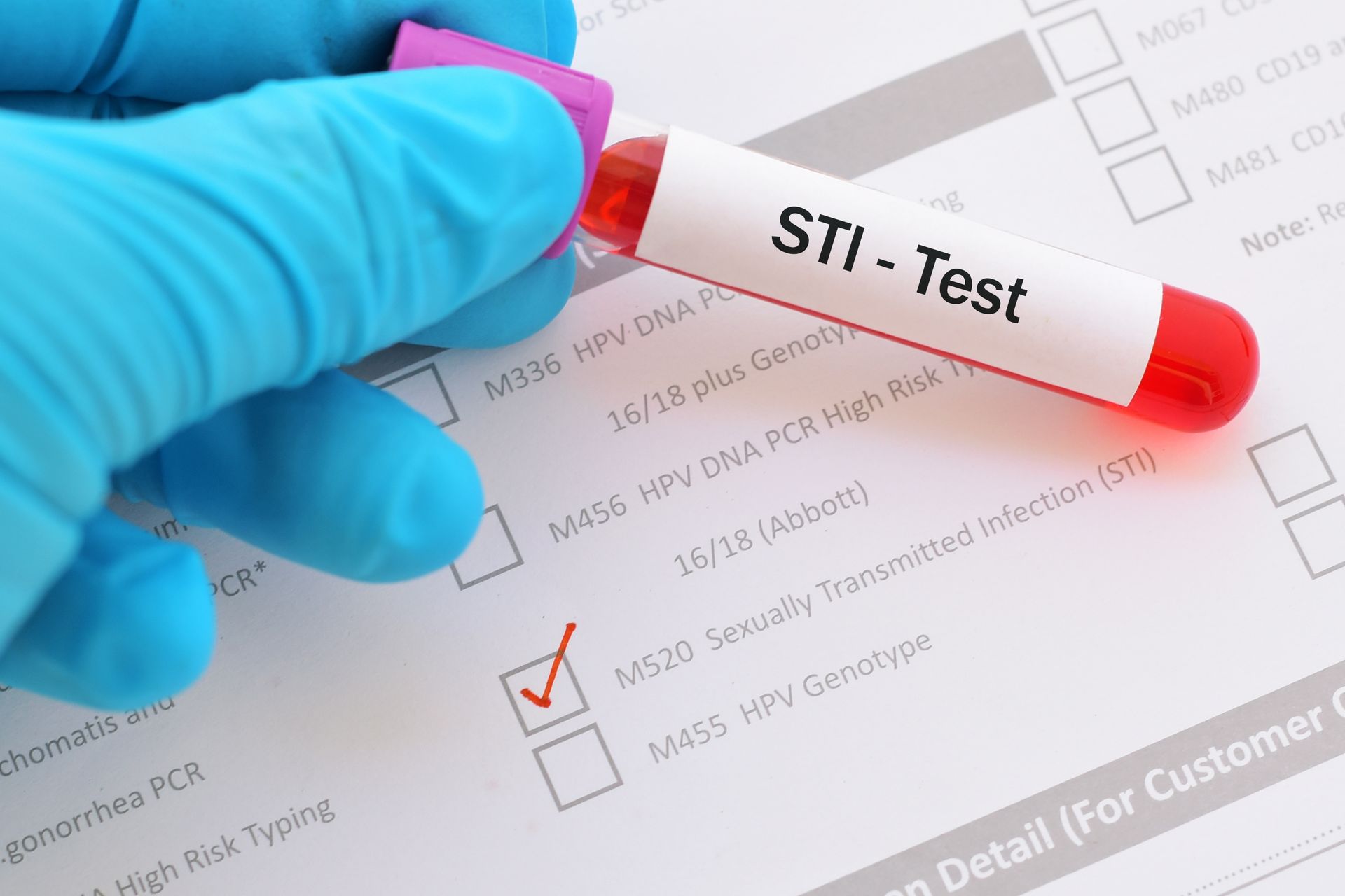 STI testing in Houston