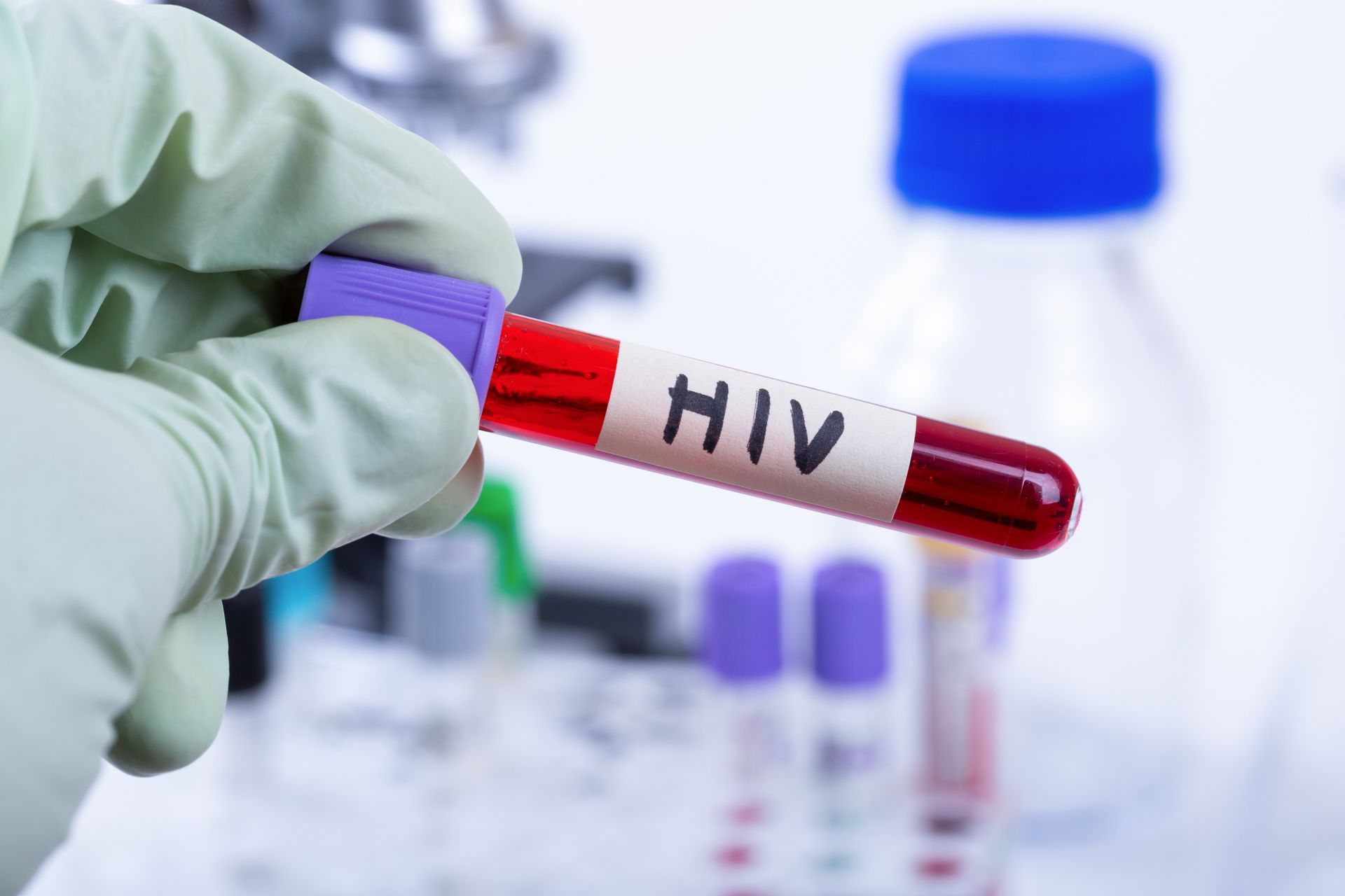 clinician handling HIV test
