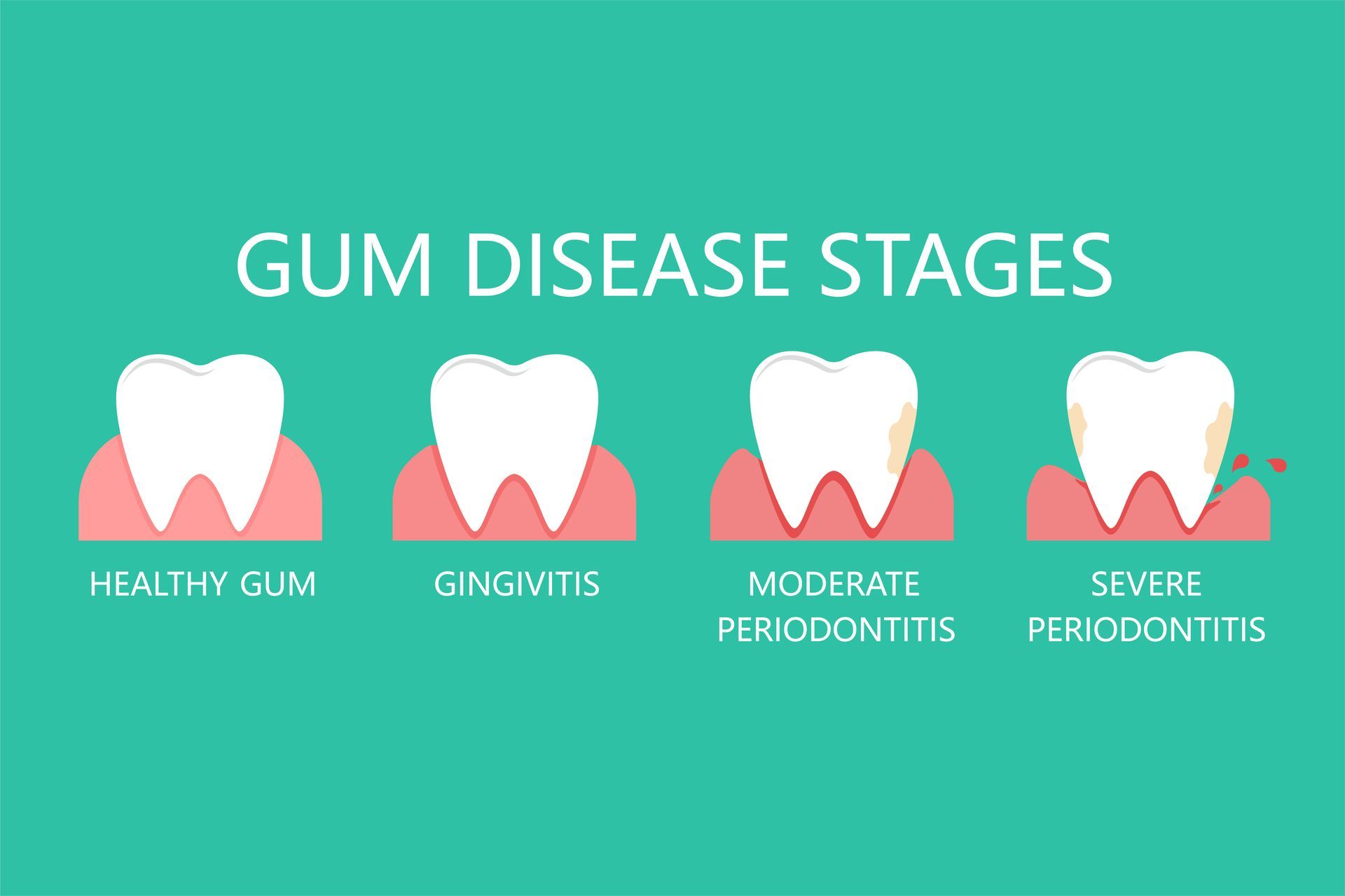 blood sugar and gum disease