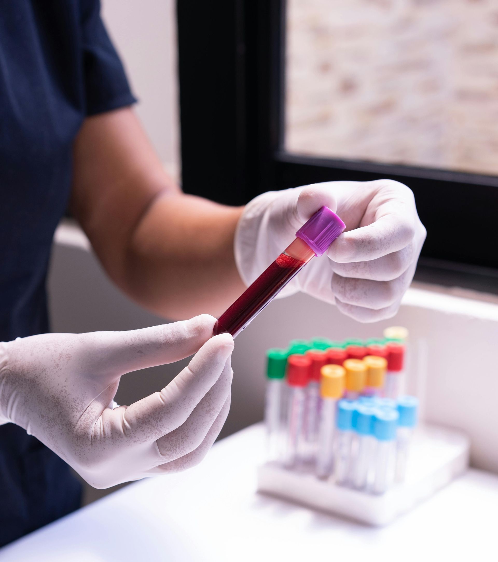 A person wearing white medical gloves holds a purple-capped blood test tube in a laboratory with a rack of tubes nearby.