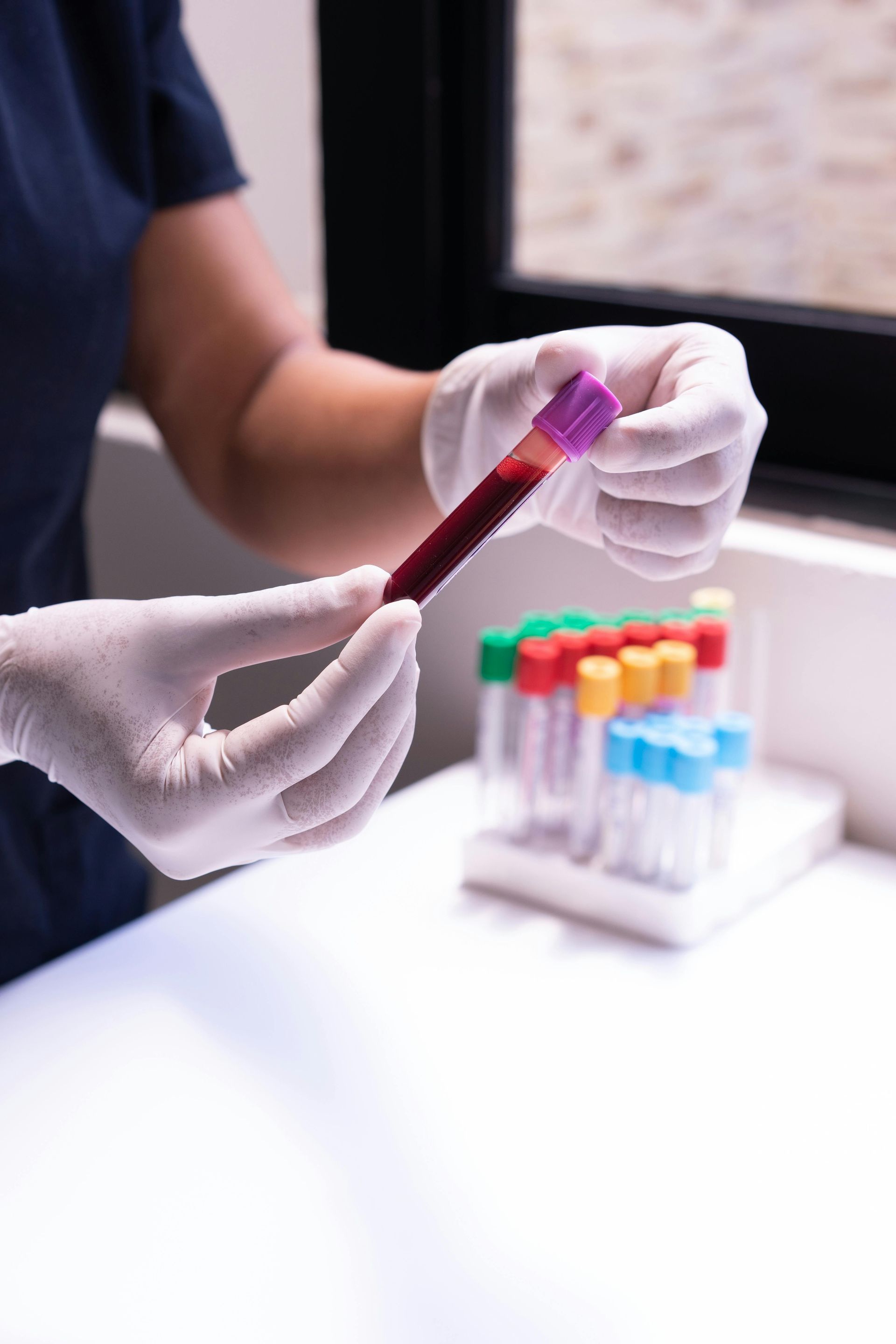 A person wearing gloves holds a purple-capped blood collection tube near a rack of various other test tubes.