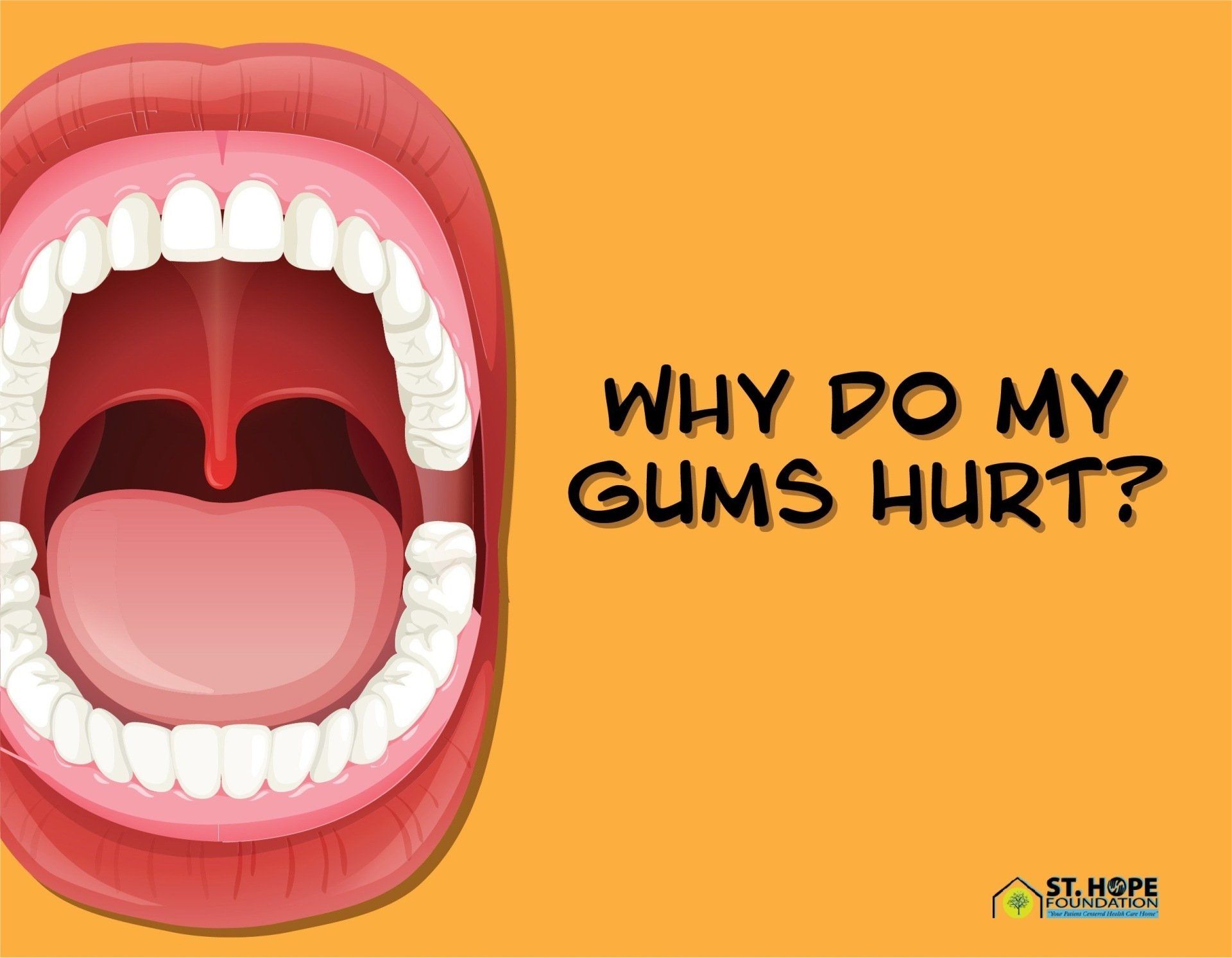 gum irritation info St. Hope Foundation