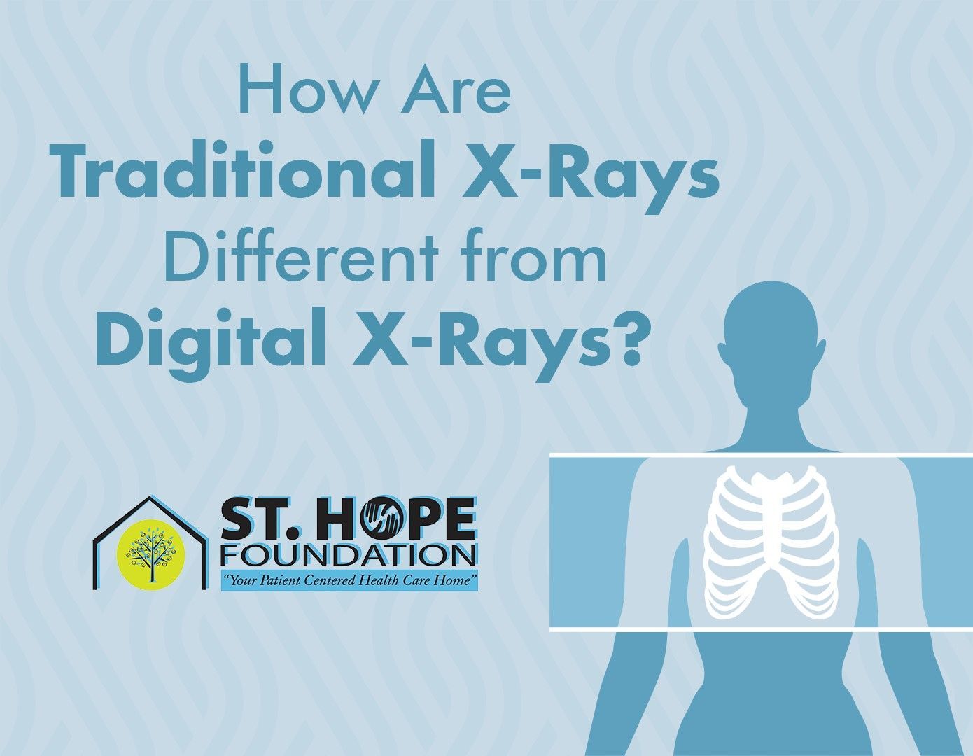 traditional x-rays vs digital x-rays