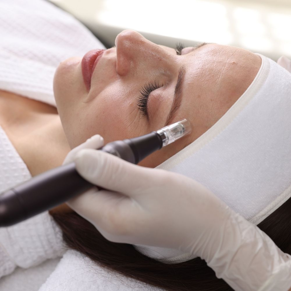Microneedling treatment with the Dr. Pen A20 device