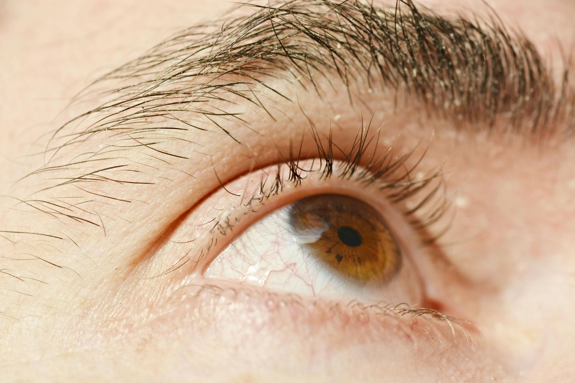 Refreshed under eye area after PRF treatment at VIOSA Aesthetics MD