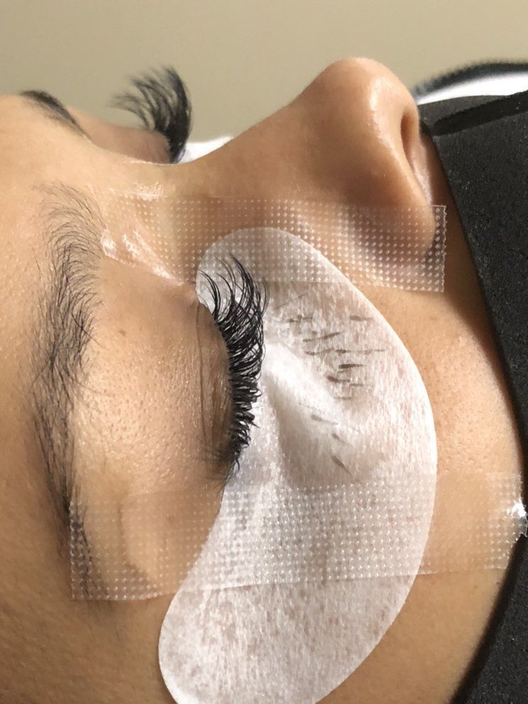 A person receiving an eyelash extension application with white eye pads and medical tape applied around the eye.