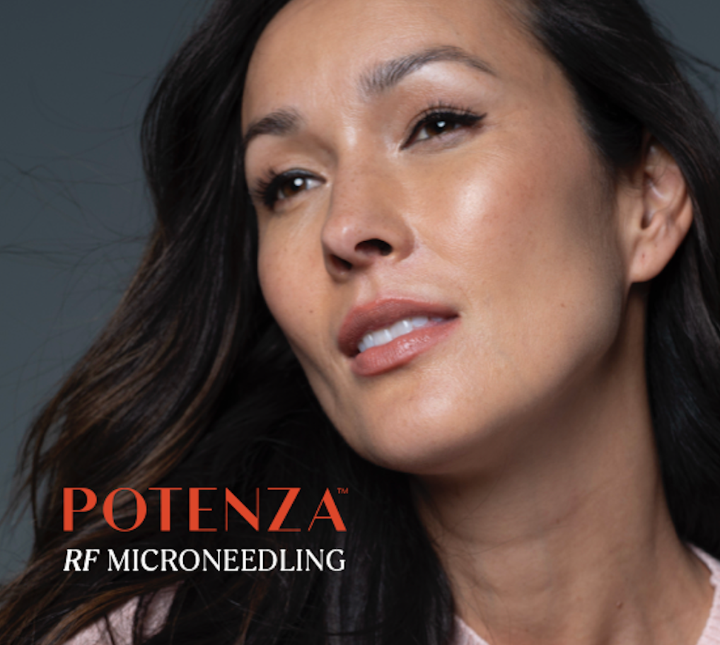 Woman with glowing skin, advertisement for Potenza RF microneedling.