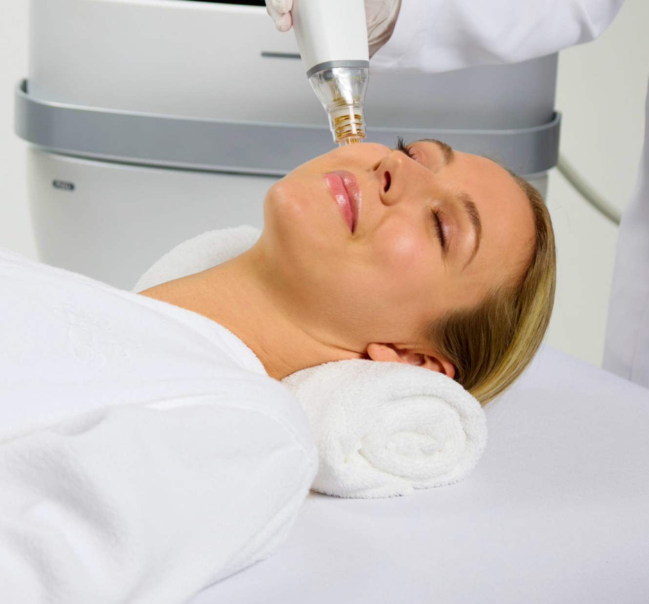 Woman receiving facial microneedling treatment with closed eyes, lying on a white table.