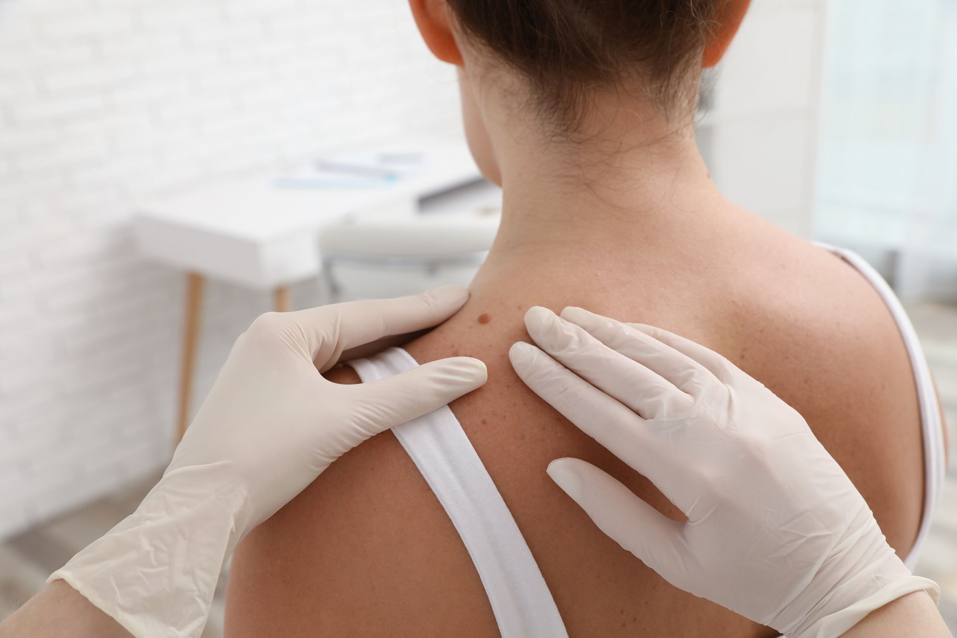 A person's back being examined by gloved hands, focusing on a mole; indoor, daytime.