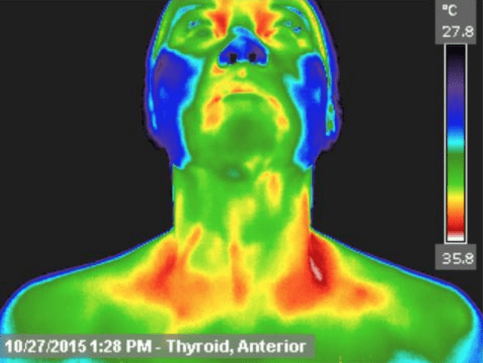 Flowwell Full Body and Breast Thermography
