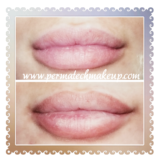Before and after photos of lip enhancement, with a visible difference in fullness and color.