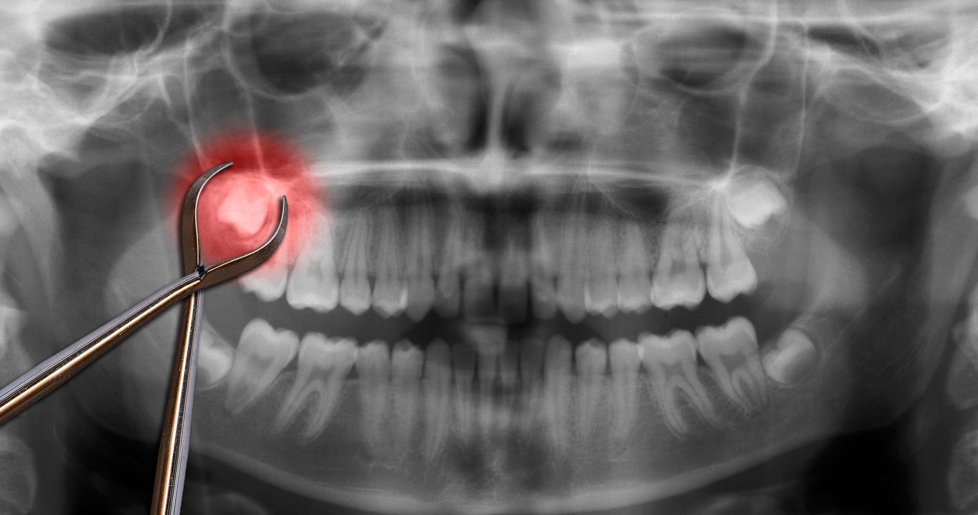 Emergency Dental Services Emergency Dental Services