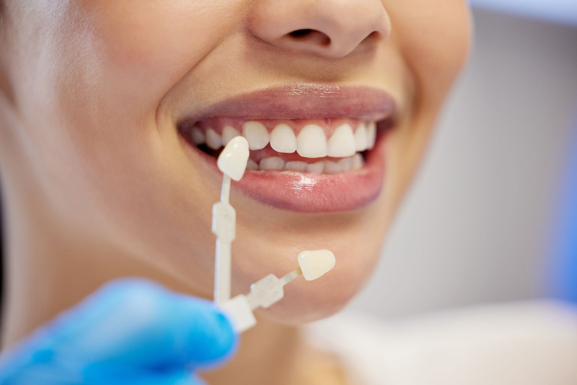 Cosmetic Dentistry Treatment