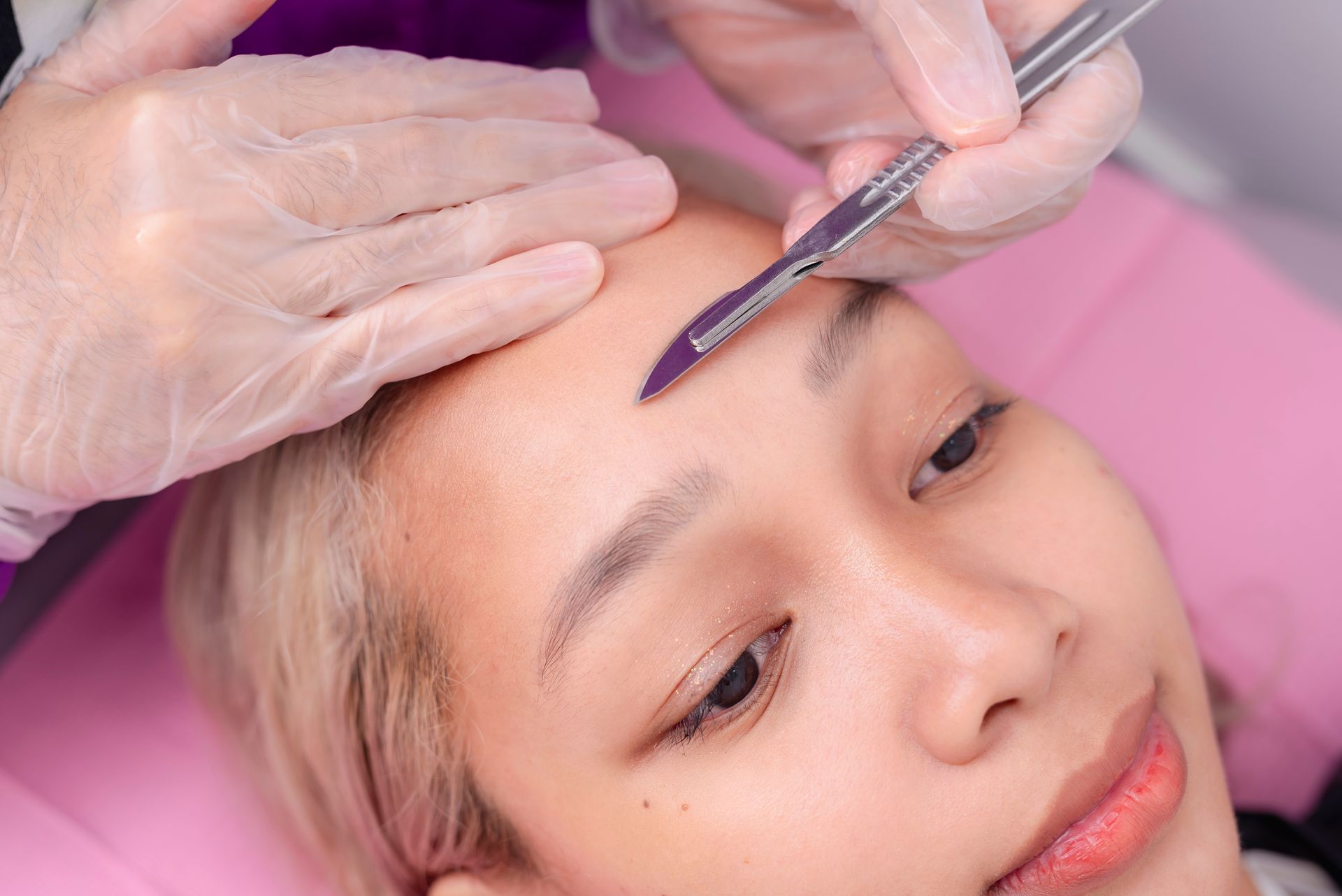 Person's brow being treated with a scalpel. They are on a pink surface. Gloved hands hold the tool.