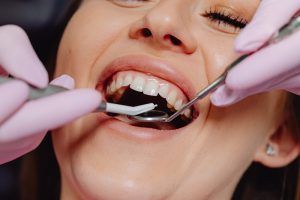 Dental tools examining a patient’s open mouth, with gloved hands and a smiling face