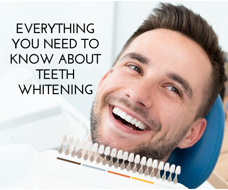 Teeth whitening promo with smiling man, text “Everything you need to know about teeth whitening”