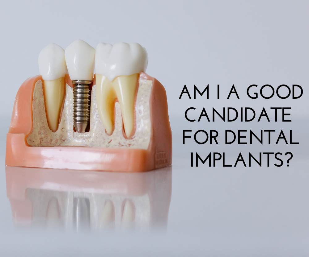 Dental implant model with text: “Am I a good candidate for dental implants?”
