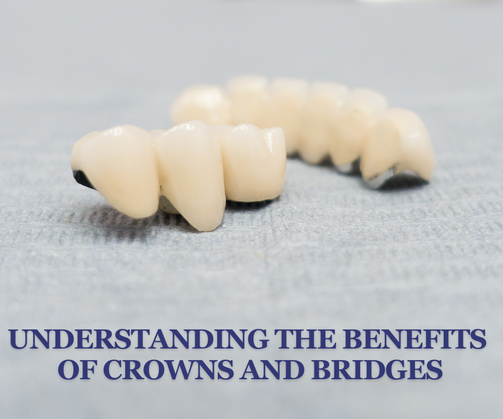 Dental crowns and bridge on a gray surface, with text reading “Understanding the Benefits of Crowns and Bridges”