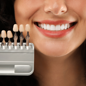 Smile with dental veneers beside a shade guide showing tooth color options