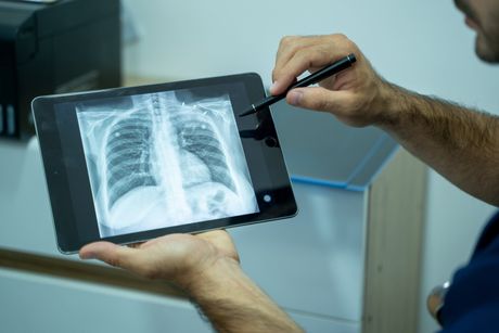 Doctor Showing The X-Ray — Metairie, LA — Xpress Ray Inc. Doctor Showing The X-Ray — Metairie, LA — Xpress Ray Inc.