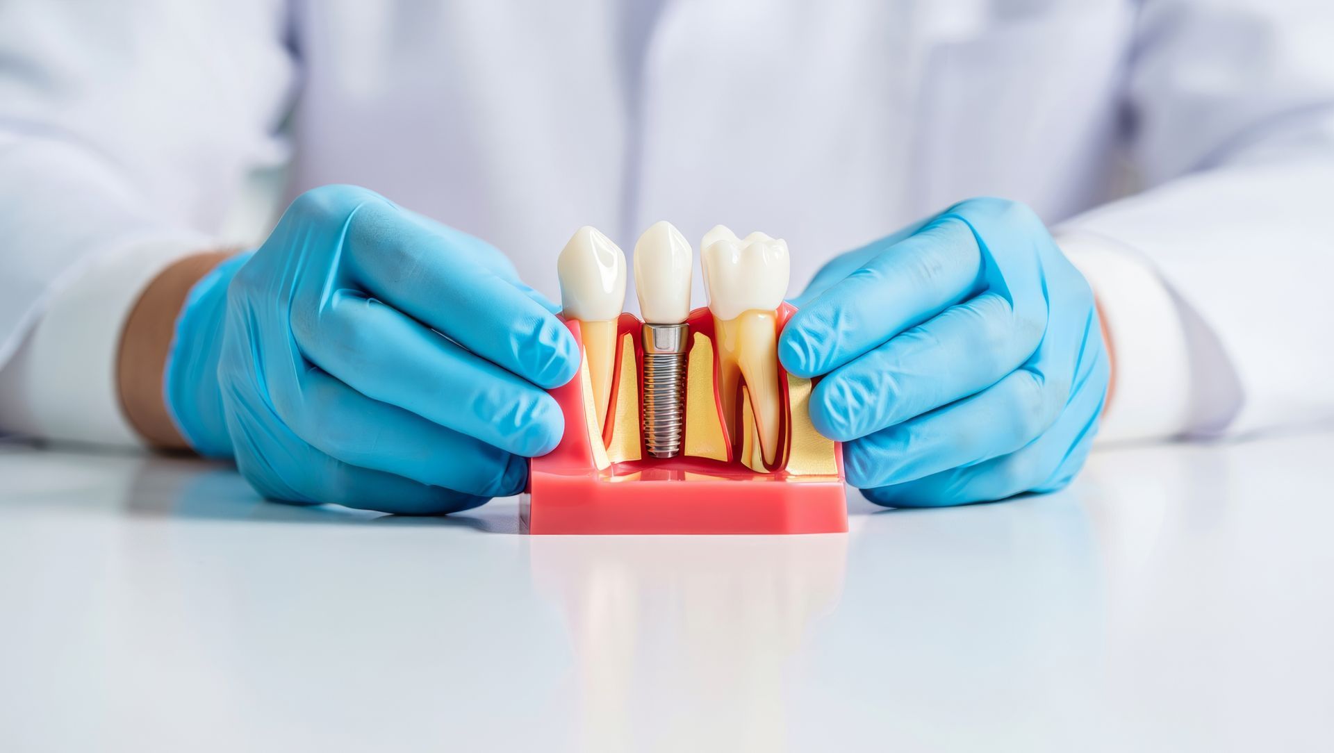 Dentist in blue gloves holding and demonstrating a dental implant model.