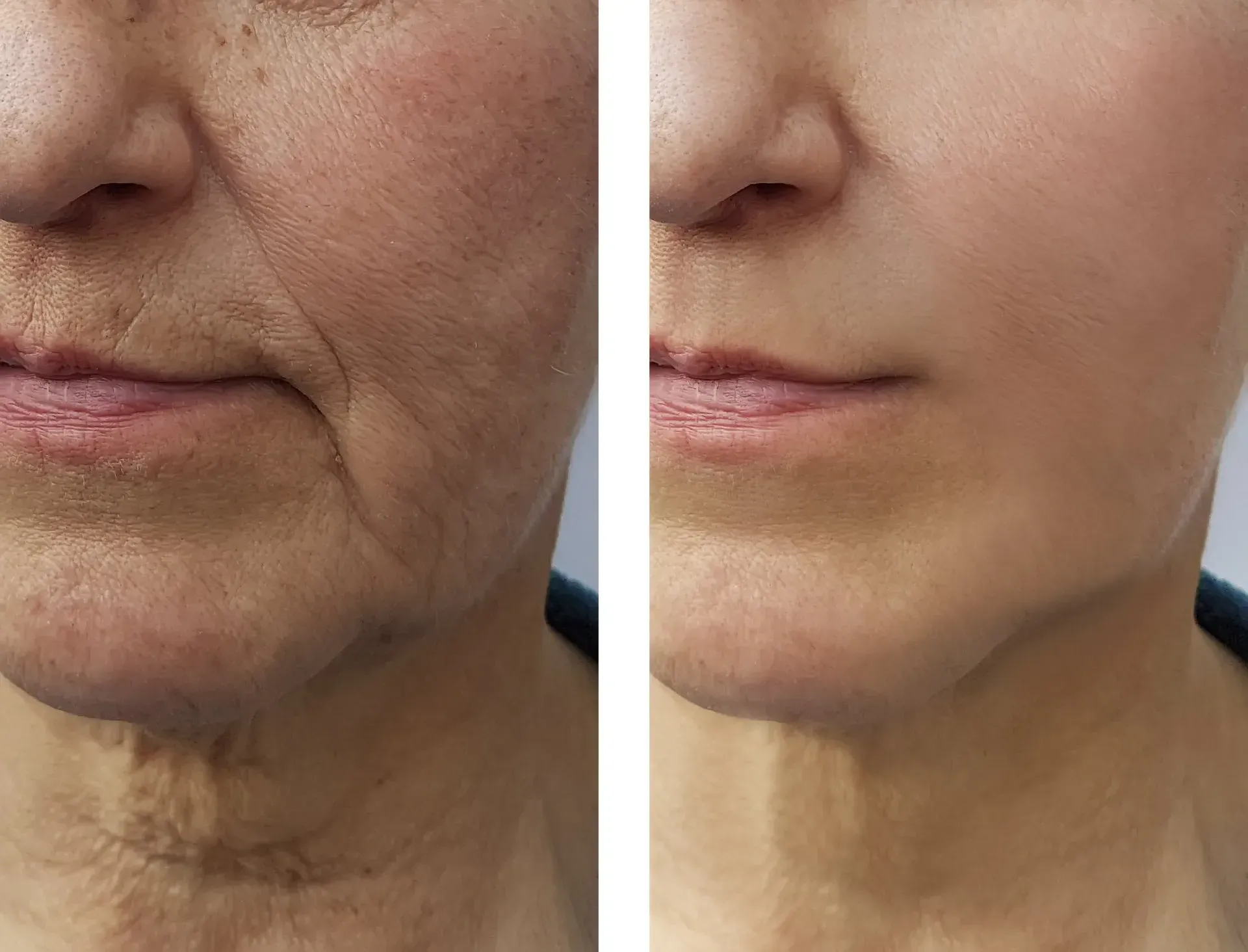 Beautiful Woman Smiling — Albuquerque, NM — Comfortable Dentistry 4U Beautiful Woman Smiling — Albuquerque, NM — Comfortable Dentistry 4U