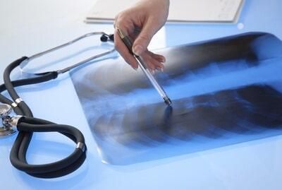RADIOLOGY MEDICAL CENTER - TOMOGRAFIAS