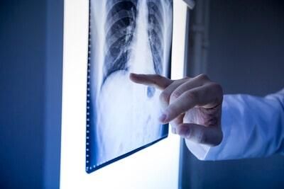 RADIOLOGY MEDICAL CENTER - RAYOS X