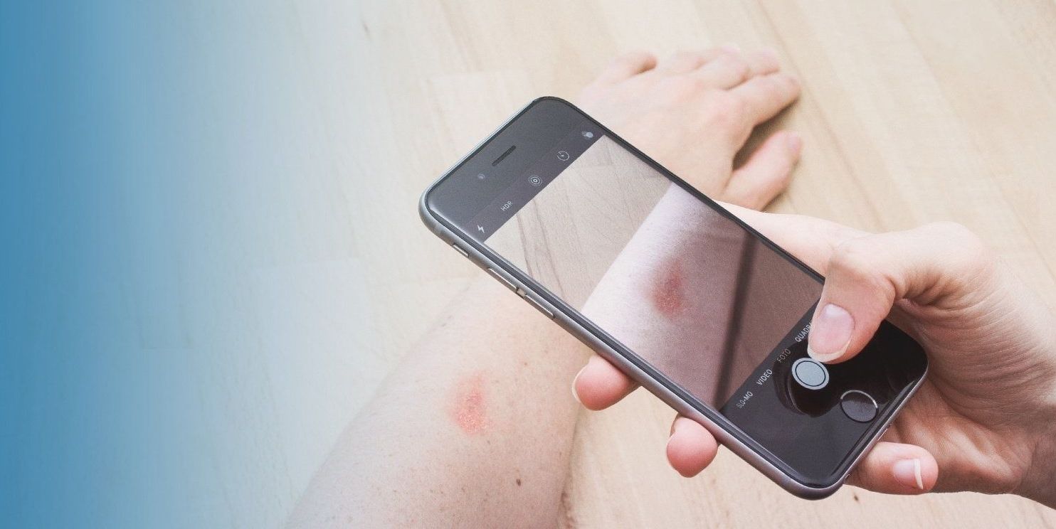 Eine Person hält ein Handy hoch, um ein Foto ihres Arms zu machen, auf dem ein Hautausschlag zu sehen ist.