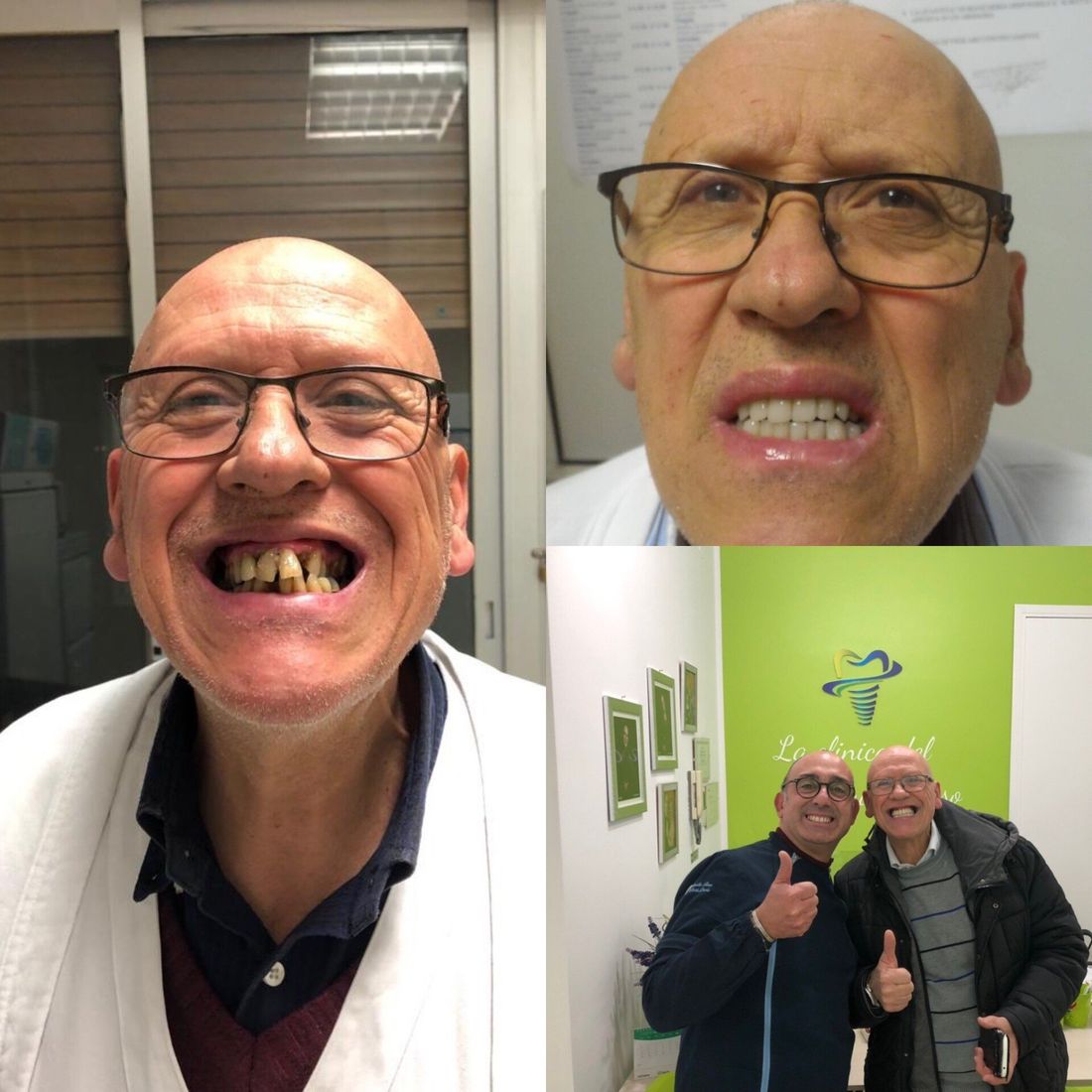 Impianti dentali