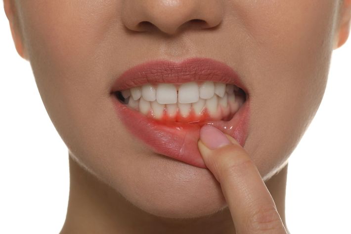 Primo piano di una persona che si morde il labbro inferiore tirandolo verso il basso con un dito, mostrando i denti e il rossetto rosso.