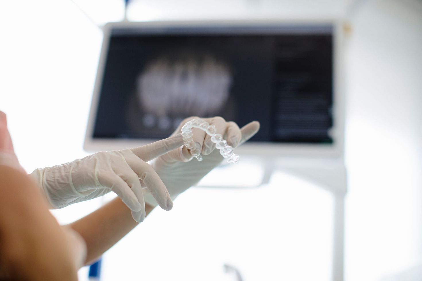 Mani guantate che reggono uno stampo dentale in un luminoso studio medico con un monitor del computer sfocato خلف