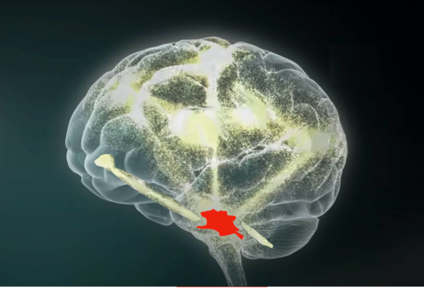 Brain with highlighted red amygdala, glow effect, on dark background.