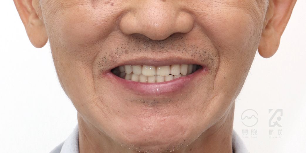 治療後