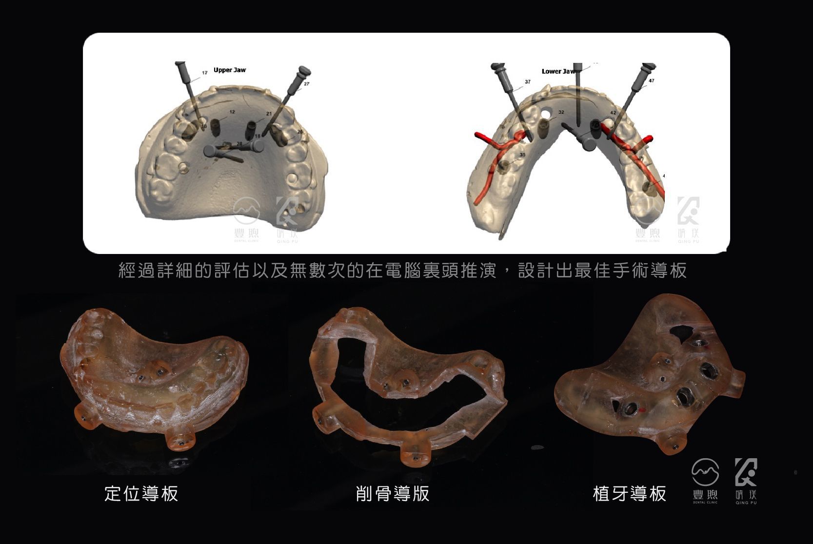 導版製作