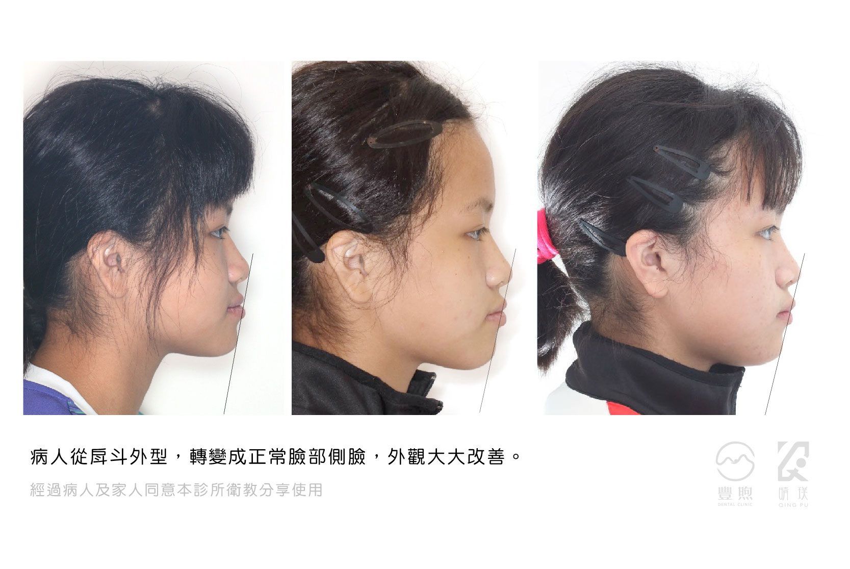 三張不同角度的年輕女孩臉部照片。