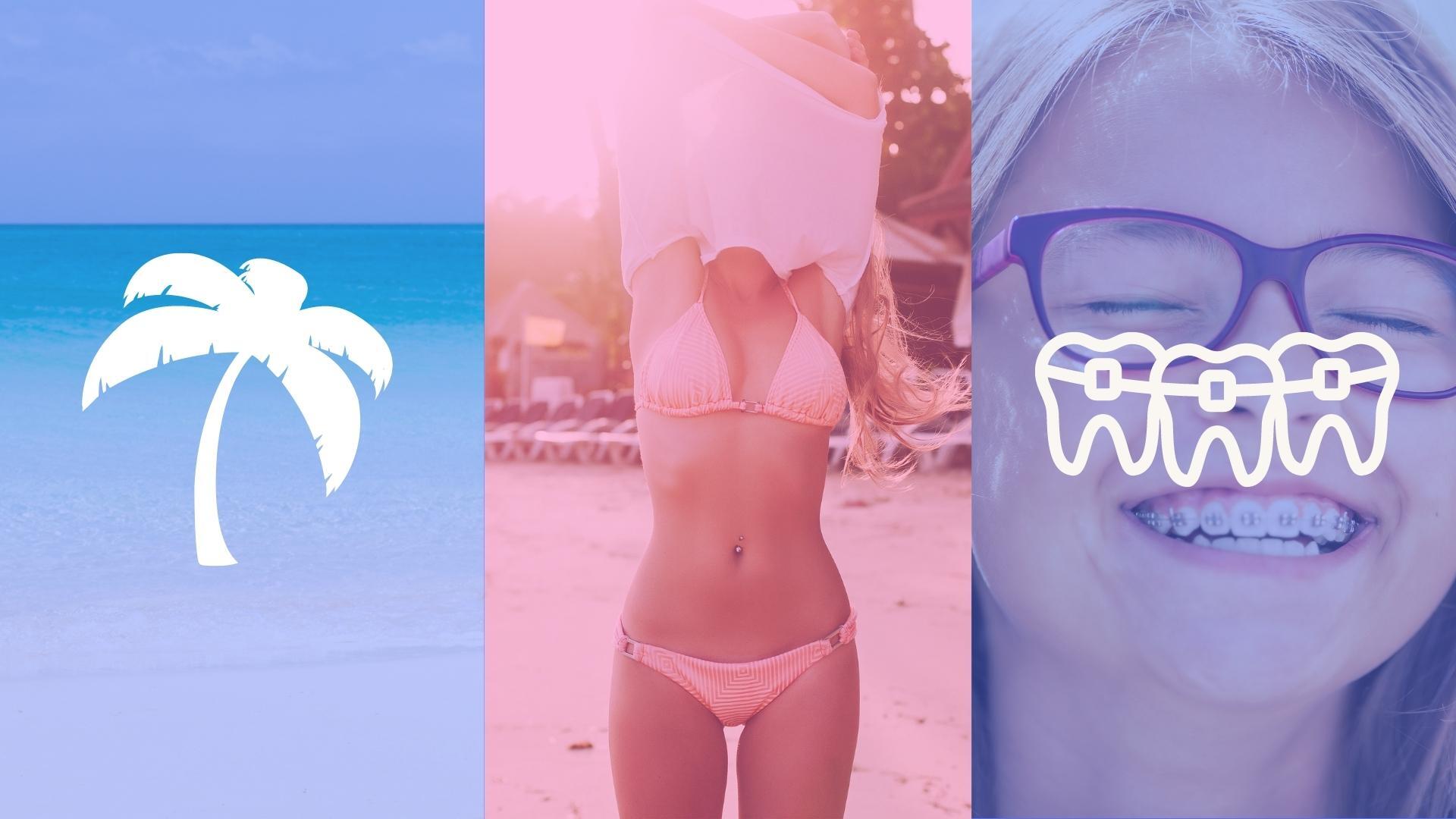Beaches, Bathing Suits and Braces