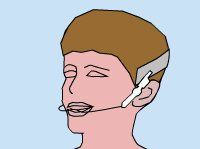 Lingual Braces