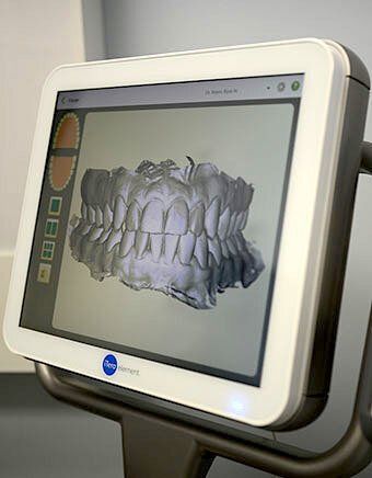 About Orthodontics