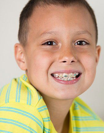 Lingual Braces
