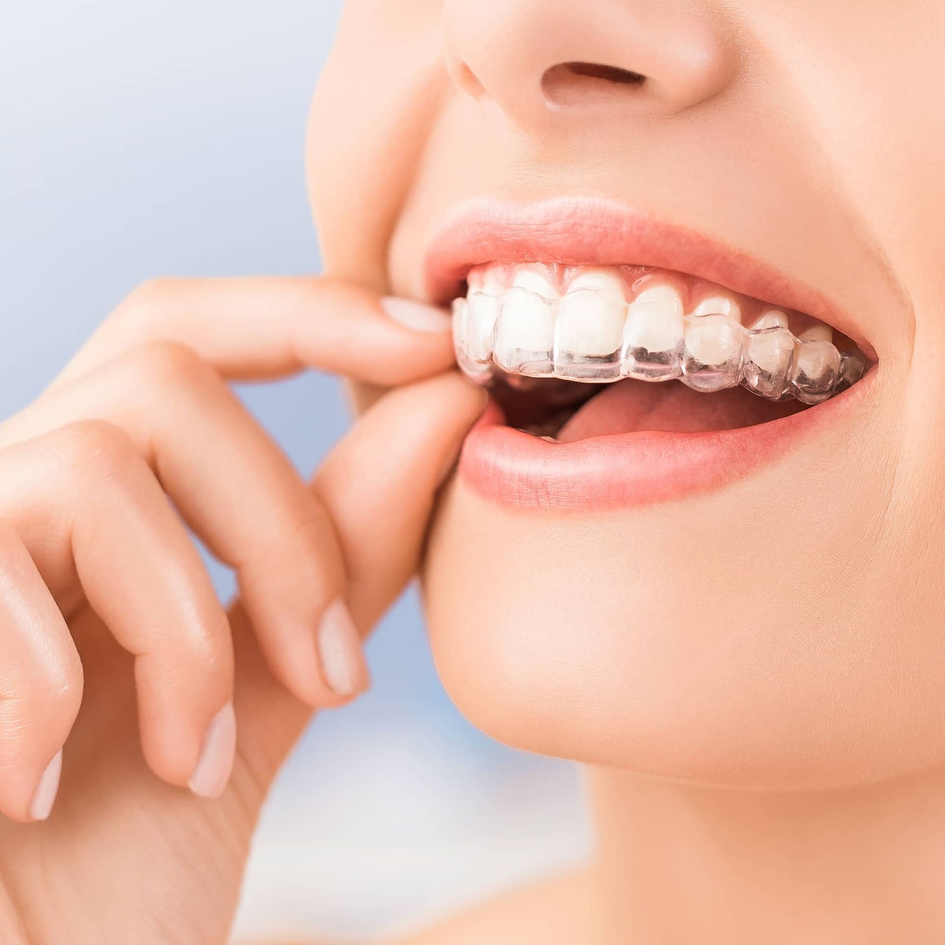 Close-up of a person smiling and adjusting clear braces on their teeth