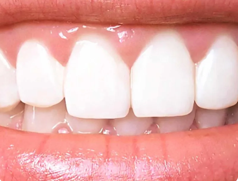 Close-up of a smiling mouth with bright white teeth and pink lips