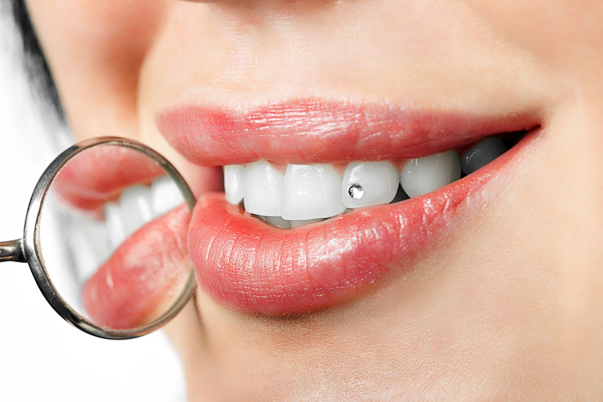 Close-up of lips and teeth with a dental mirror inspecting a chipped front tooth
