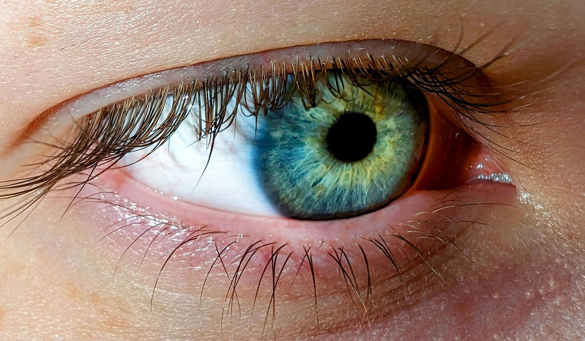 Close-up of a Brown Eye, With Visible Iris Details and Long Eyelashes — All Body Holistic Health in Thuringowa Central, QLD