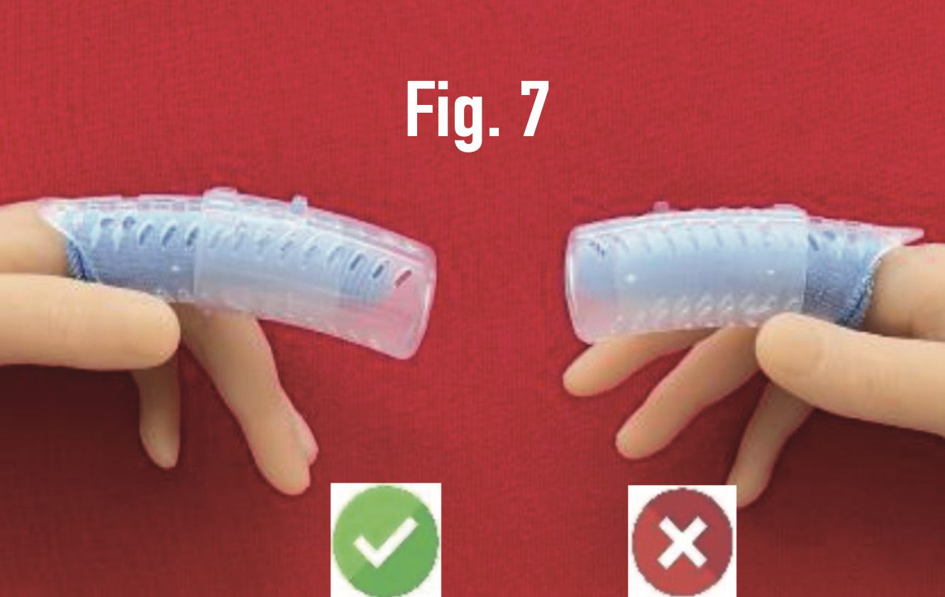 Two hands holding a curved DigiTube blue splint; left marked correct with green check, right incorrect with red X.