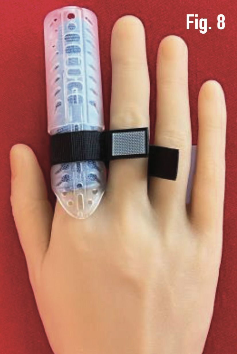 Hand with a clear DigiTube plastic finger splint strapped across two fingers against a red background.