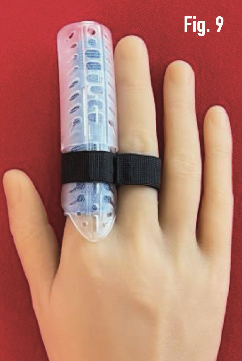 Hand wearing a DigiTube clear plastic finger splint or brace on the index finger