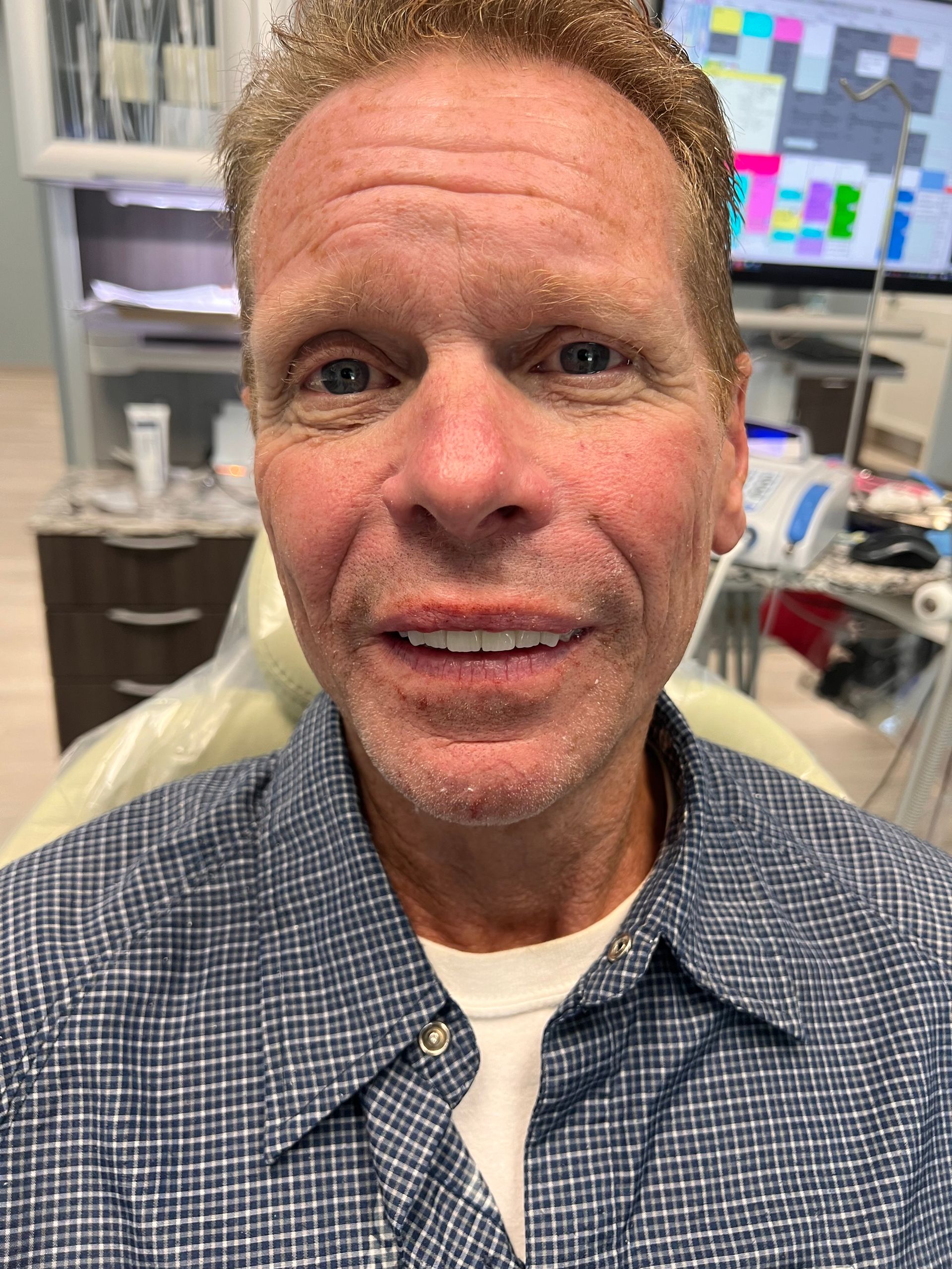 Mono Implant Case 9  After